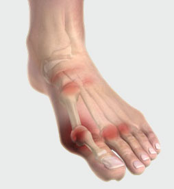 foot
