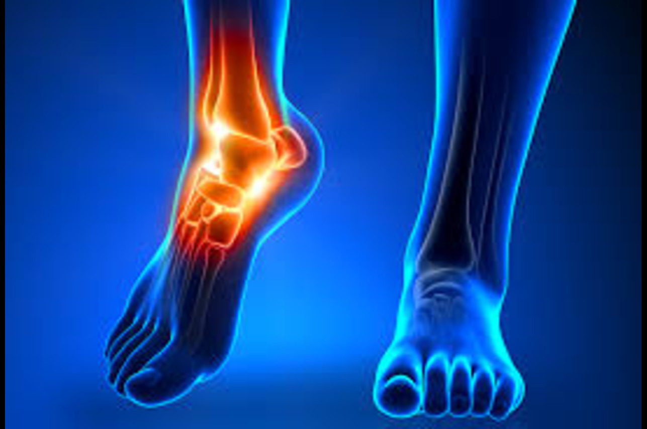 Ankle